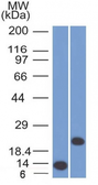 Anti-CD3 epsilon antibody [C3e/1308] used in Western Blot (WB). GTX34481