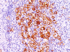 Anti-CD30 antibody [CD30/412] used in IHC (Paraffin sections) (IHC-P). GTX34483