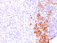 Anti-CD30 antibody [SPM609] used in IHC (Paraffin sections) (IHC-P). GTX34485