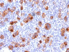 Anti-CD30 antibody [rKi-1/779] used in IHC (Paraffin sections) (IHC-P). GTX34486
