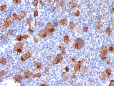 Anti-CD30 antibody [Ki-1/1747R] used in IHC (Paraffin sections) (IHC-P). GTX34488