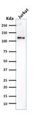 Anti-CD31 antibody [SPM532] used in Western Blot (WB). GTX34491