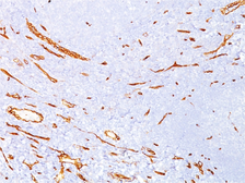 Anti-CD34 antibody [QBEnd/10] used in IHC (Paraffin sections) (IHC-P). GTX34497