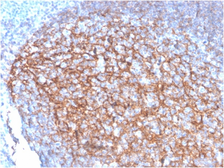 Anti-CD35 antibody [SPM554] used in IHC (Paraffin sections) (IHC-P). GTX34503