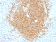 Anti-CD40 antibody [C40/1605] used in IHC (Paraffin sections) (IHC-P). GTX34506