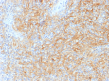 Anti-CD40 antibody [C40/1605] used in IHC (Paraffin sections) (IHC-P). GTX34506