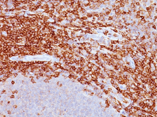 Anti-CD43 antibody [SPM503] used in IHC (Paraffin sections) (IHC-P). GTX34507