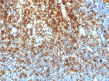 Anti-CD43 antibody [SPN/1766R] used in IHC (Paraffin sections) (IHC-P). GTX34512