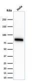 Anti-CD44 antibody [SPM544] used in Western Blot (WB). GTX34514