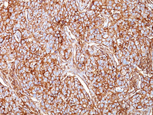 Anti-CD44 antibody [SPM521] used in IHC (Paraffin sections) (IHC-P). GTX34515
