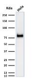 Anti-CD44 antibody [SPM521] used in Western Blot (WB). GTX34515