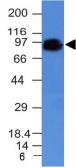 Anti-CD44 antibody [HCAM/918] used in Western Blot (WB). GTX34516