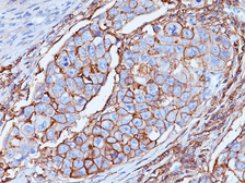 Anti-CD44 antibody [DF1485] used in IHC (Paraffin sections) (IHC-P). GTX34517
