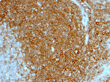 Anti-CD44 antibody [HCAM/1097] used in IHC (Paraffin sections) (IHC-P). GTX34518