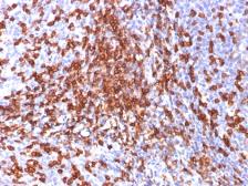 Anti-CD44 antibody [156-3C11] used in IHC (Paraffin sections) (IHC-P). GTX34519