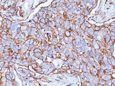 Anti-CD44 antibody [156-3C11] used in IHC (Paraffin sections) (IHC-P). GTX34519