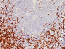 Anti-CD5 antibody [C5/473] used in IHC (Paraffin sections) (IHC-P). GTX34524