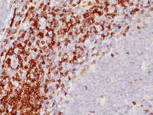 Anti-CD5 antibody [SPM546] used in IHC (Paraffin sections) (IHC-P). GTX34525