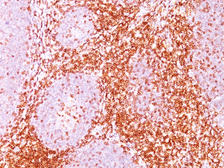 Anti-CD6 antibody [C6/372] used in IHC (Paraffin sections) (IHC-P). GTX34536
