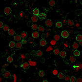 Anti-CD6 antibody [SPM547] used in Immunocytochemistry/ Immunofluorescence (ICC/IF). GTX34537