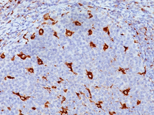 Anti-CD68 antibody [KP1] used in IHC (Paraffin sections) (IHC-P). GTX34542