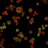 Anti-CD74 antibody [LN-2] used in Immunocytochemistry/ Immunofluorescence (ICC/IF). GTX34551