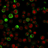 Anti-CD74 antibody [SPM523] used in Immunocytochemistry/ Immunofluorescence (ICC/IF). GTX34552