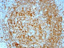 Anti-CD74 antibody [CLIP/813] used in IHC (Paraffin sections) (IHC-P). GTX34553