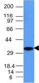Anti-CD74 antibody [CLIP/1133] used in Western Blot (WB). GTX34554