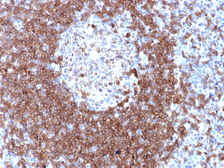 Anti-CD79a antibody used in IHC (Paraffin sections) (IHC-P). GTX34555
