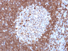 Anti-CD79a antibody [JCB117] used in IHC (Paraffin sections) (IHC-P). GTX34556