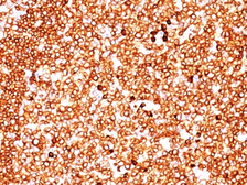 Anti-CD79a antibody [SPM549] used in IHC (Paraffin sections) (IHC-P). GTX34557