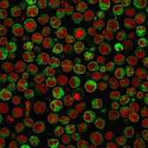 Anti-CD79a antibody [SPM550] used in Immunocytochemistry/ Immunofluorescence (ICC/IF). GTX34558