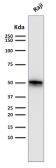 Anti-CD79a antibody [SPM550] used in Western Blot (WB). GTX34558