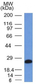 Anti-CD79a antibody [IGA/1406] used in Western Blot (WB). GTX34561
