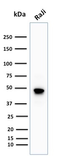 Anti-CD79a antibody [IGA/1688R] used in Western Blot (WB). GTX34562