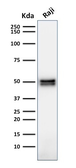Anti-CD79a antibody [HM47/A9] used in Western Blot (WB). GTX34563