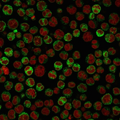 Anti-CD79a antibody [HM57] used in Immunocytochemistry/ Immunofluorescence (ICC/IF). GTX34564