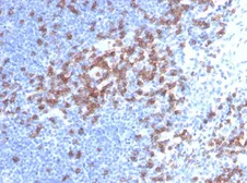 Anti-CD8 alpha antibody [C8/468] used in IHC (Paraffin sections) (IHC-P). GTX34565