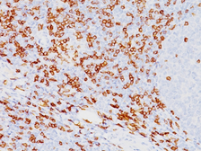 Anti-CD8 alpha antibody [SPM548] used in IHC (Paraffin sections) (IHC-P). GTX34566