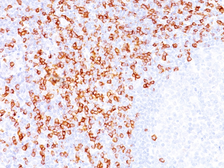 Anti-CD8 alpha antibody [C8/144B] used in IHC (Paraffin sections) (IHC-P). GTX34567
