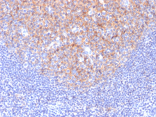 Anti-CD81 antibody [1.3.3.22] used in IHC (Paraffin sections) (IHC-P). GTX34568