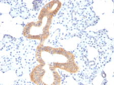 Anti-CD86 antibody [SPM600] used in IHC (Paraffin sections) (IHC-P). GTX34570