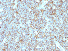 Anti-CD99 antibody [MIC2/1495R] used in IHC (Paraffin sections) (IHC-P). GTX34575