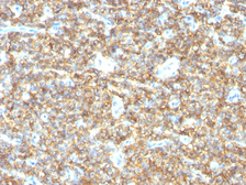 Anti-CD99 antibody [HO36-1.1] used in IHC (Paraffin sections) (IHC-P). GTX34576
