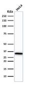 Anti-CDC2 antibody [CDK1/873] used in Western Blot (WB). GTX34577