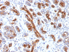 Anti-CFTR antibody [CFTR/1341] used in IHC (Paraffin sections) (IHC-P). GTX34586