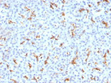 Anti-CFTR antibody [CFTR/1342] used in IHC (Paraffin sections) (IHC-P). GTX34587