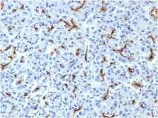 Anti-CFTR antibody [CFTR/1643] used in IHC (Paraffin sections) (IHC-P). GTX34589