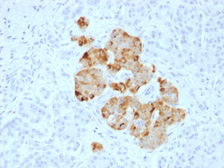 Anti-Chromogranin A antibody used in IHC (Paraffin sections) (IHC-P). GTX34592